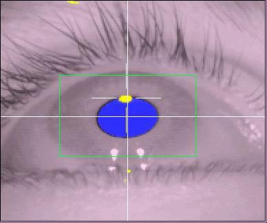 If the eye image is too small, the eye tracking resolution