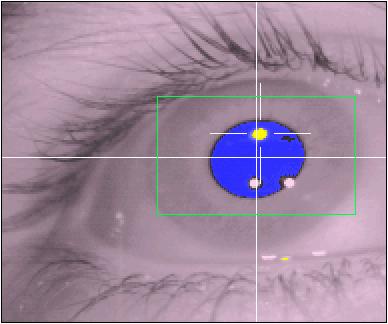 Good Figure 3-3: Horizontal Adjustments of Eye Camera Finally, the height of the eye camera below the eye may need to be adjusted, as in the middle row of Figure 11.