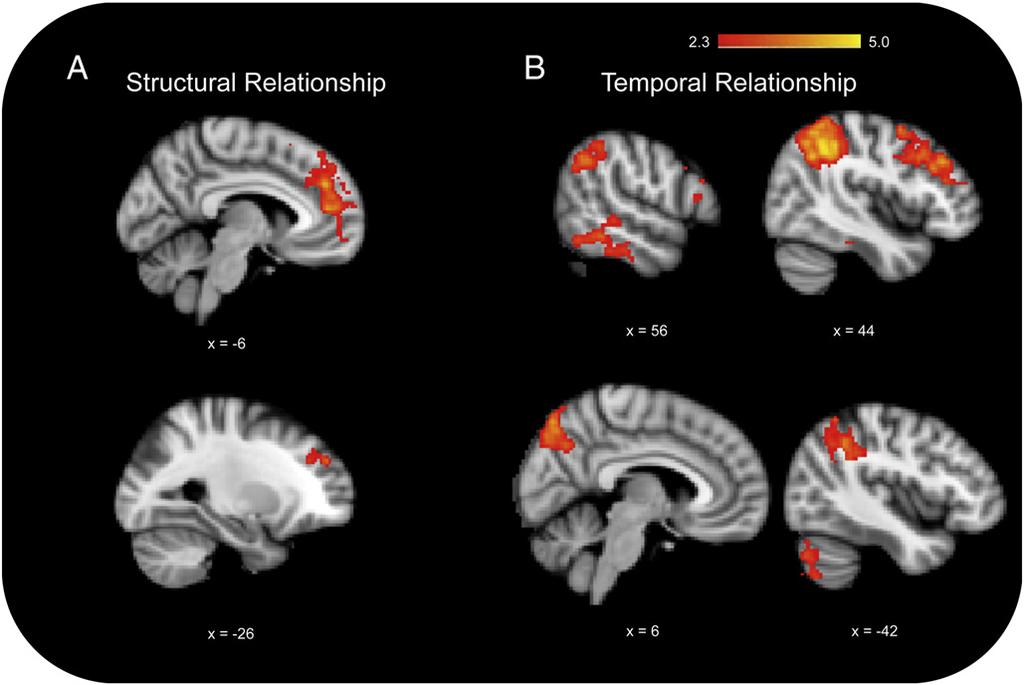 M. Uhlig et al. / NeuroImage 77 (2013) 52 61 57 Fig. 2. Main effects of leader follower relationship factors.