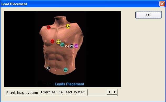Operation Instructions for Exercise ECG Chapter 7 Operation Instructions for Exercise ECG The exercise ECG function is optional. It is available only if you purchased this function. 7.1 Viewing Lead Placement Information 1.