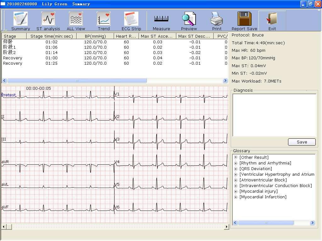 Operation Instructions for Exercise ECG 7.9 About Analysis Screen 7.9.1 About Summary Screen 1. Click on Summary to open the Summary screen.