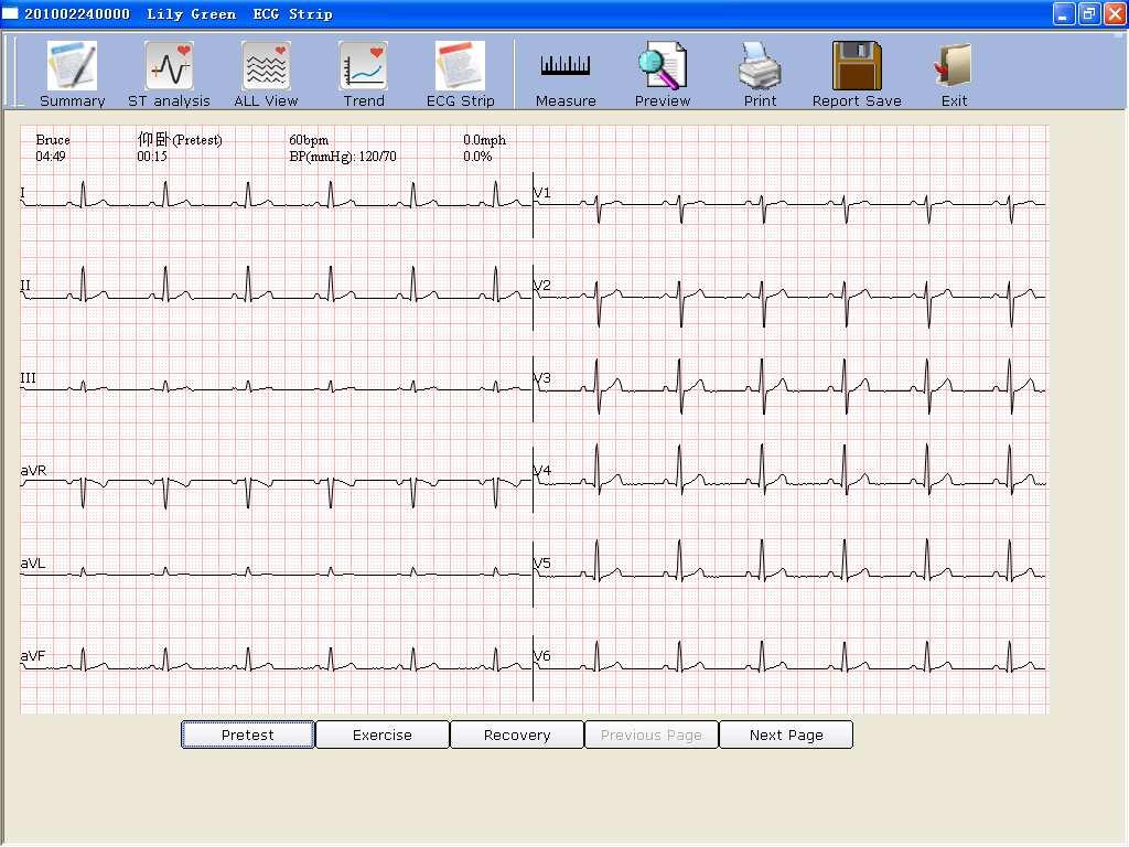 Operation Instructions for Exercise ECG 7.9.5 About ECG Strip Screen Click on the ECG Strip button to display the ECG Strip screen. Figure 7-8 ECG Strip Screen 1.
