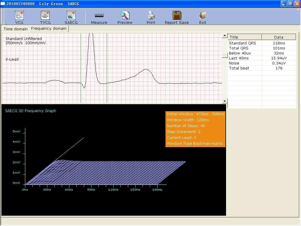 Operation Instructions for Resting ECG Select a filter in the Filter pull-down list. The top of the Time domain window is the window of standard superimposed QRS waveform.