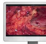 surgeons preferences Full HD 60fps video recording Full HD image saving USB pen