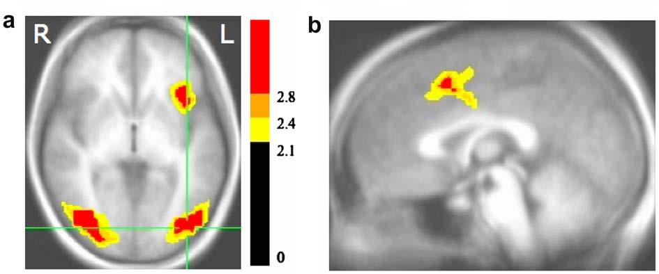 G.C. Cupchik et al. / Brain and Cognition 70 (2009) 84 91 87 are reported as significant if the spatial extent of the activation exceeded a threshold of t > 2.