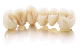 pontics), full arch tasks (orthodontia) and implant impressions.