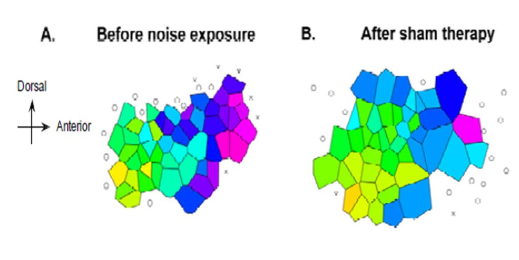 in the auditory cortex in after noise trauma