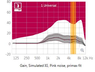 How it works The notch is placed at the center frequency of the tinnitus in an area of audibility.