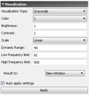 SIGNAL ANALYSIS In the Visualization field specify: Figure 84 Visualization field 1) Visualization Type: Grayscale, Right deviation, Color.