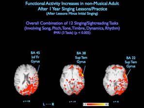 lexicon imagined singing Vocal plan formation Associative memories Song melody Song lyrics Kleber, et al, 2006 A neurological perspective: Activity changes brain function A
