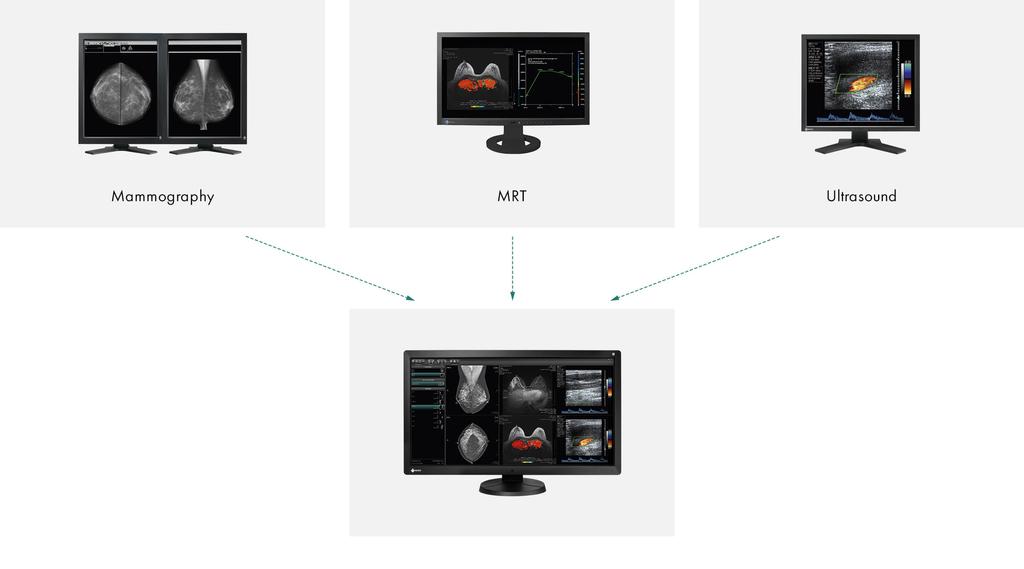 Consistently secure image quality The optional EIZO RadiCS software to secure image quality enables extensive maintenance and testing of monitors and includes calibration, acceptance and constancy