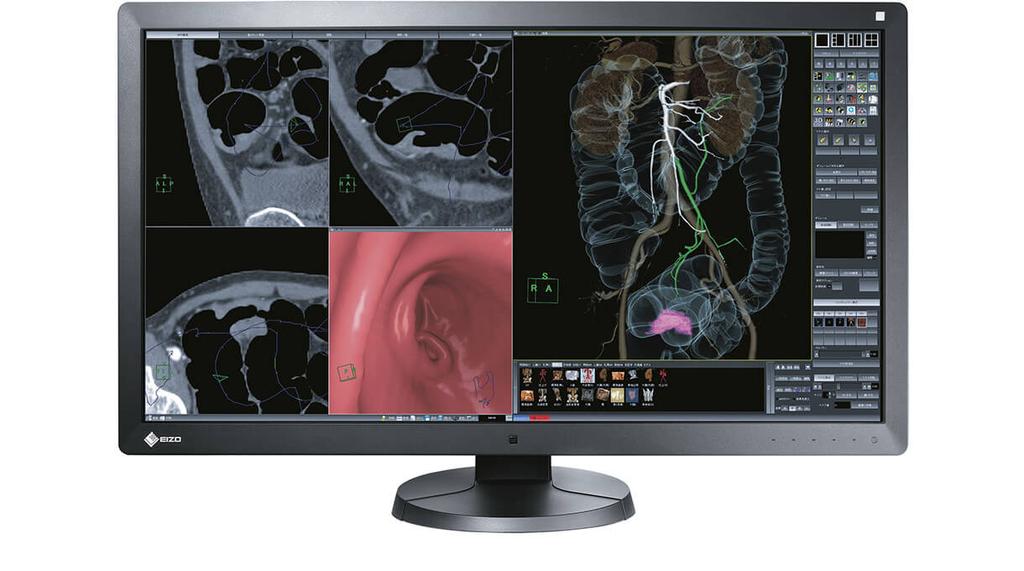 Optimised workflows The multi-modality RX850 monitor can display 8 Megapixels (colour) of image data, without the annoying frame, which is unavoidable in setups with multiple
