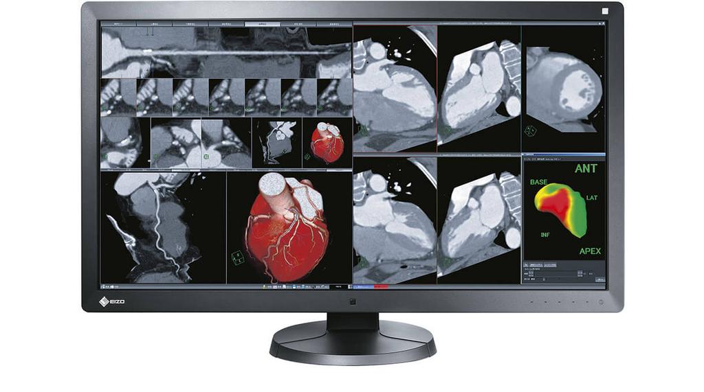 This multi-modality solution provides plenty of space to display all of the imaging applications required and thereby improves the workflows in radiology, as well as increasing