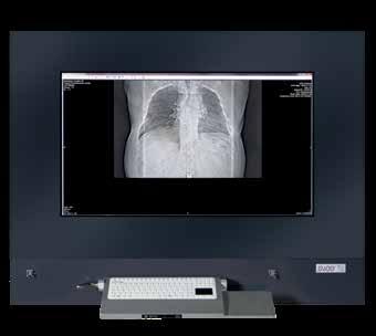 DIGITAL AND ANALOG IMAGES VIEWING STATION (PACS, RIS, HIS) FOR OPERATING ROOM ON