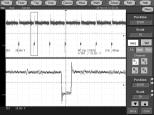 To See More Waveform Detail Use Zoom Use the Zoom function to magnify an acquisition vertically, horizontally, or in both waveform dimensions.
