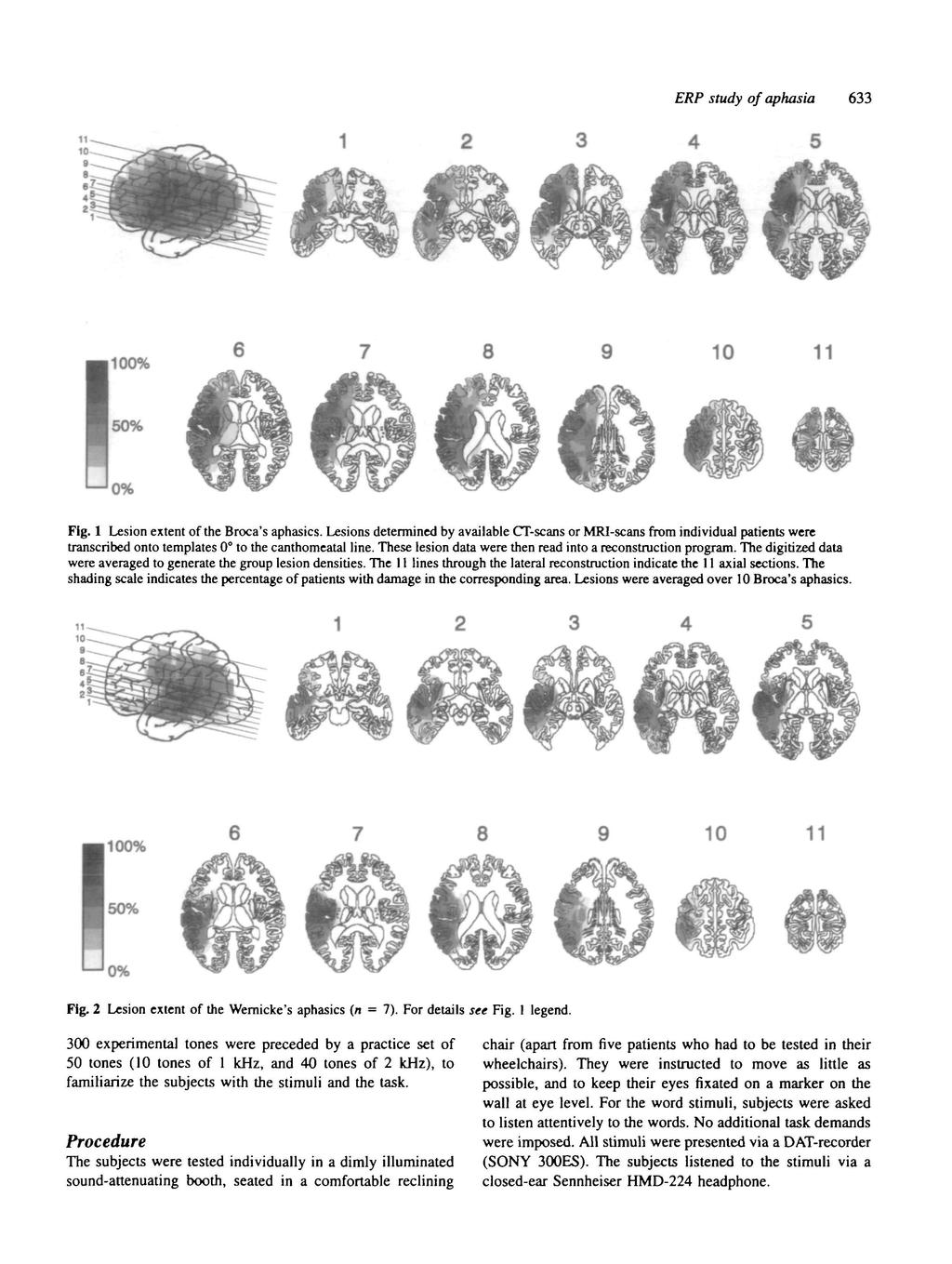 ERP study of aphasia 633 4 5 1100% 6 8 10 11 50% '0% Fig. 1 Lesion extent of the Broca's aphasics.