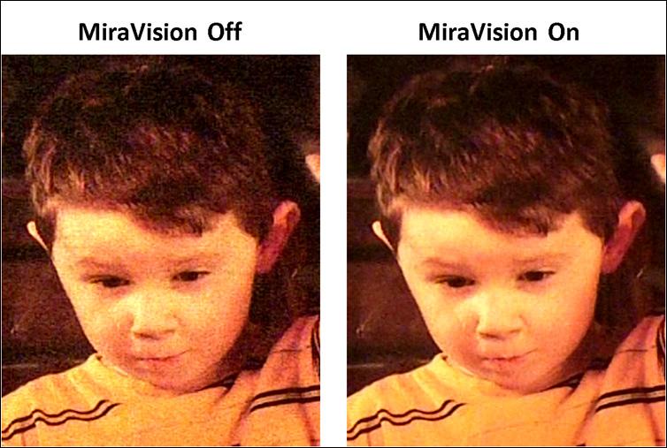 MiraVision Compression Noise Reduction