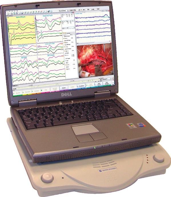 EEG waveforms are displayed and stored continuously and/or periodically and the waveforms can be displayed in a waterfall format in either CSA or DSA.