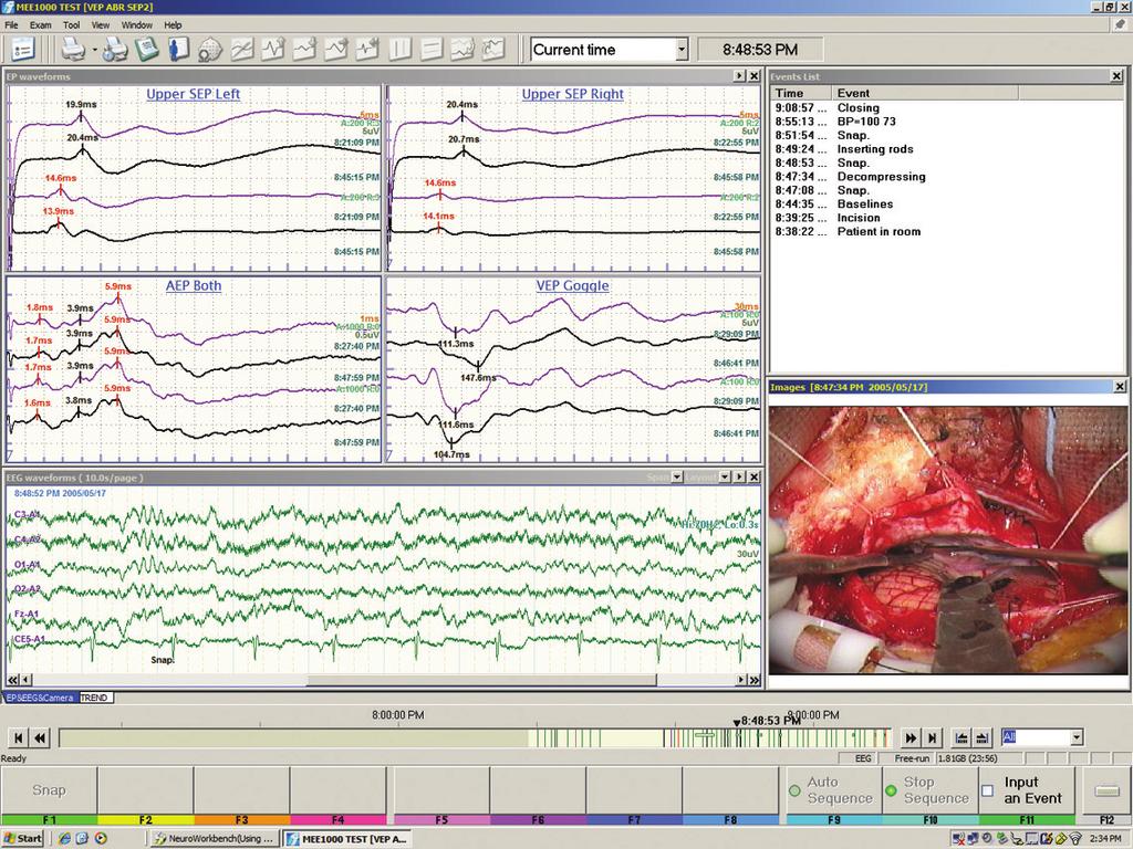 EP Window Up to 32 EP waveforms in 6 displays areas Baseline, current and previous