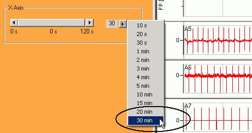 You can also move the slider for jumping to a specific position. 5. Double-click a channel window to zoom into the data recorded from the specific well.