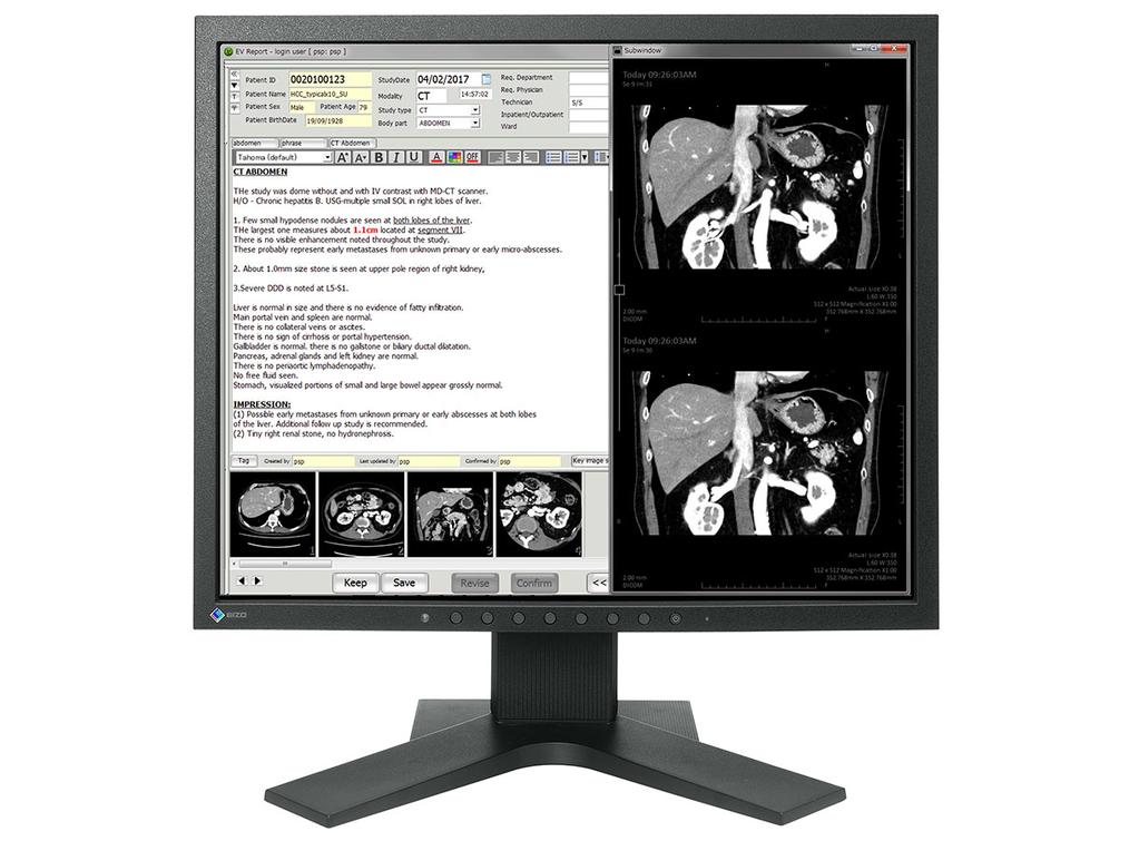 MX194 Your advantages The 19-inch MX194 with a traditional 5:4 aspect ratio stands out thanks to its factory-preset DICOM characteristic curve, which guarantees faithful reproduction of radiological