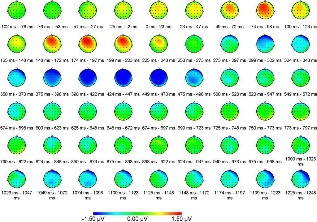 1276 Ş.B. Demiral et al. / Neuropsychologia 50 (2012) 1271 1285 Fig. 3. Scalp maps of the difference between the Incongruent and Congruent conditions, shown for each 25 ms time-bin in Experiment 1.