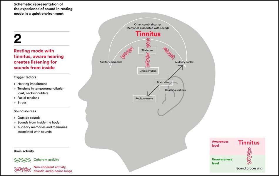 Figure 2. Resting mode with tinnitus, aware hearing creates listening for sounds from inside. Figure 3. Normal resting mode without tinnitus, after treatment with Antinitus.