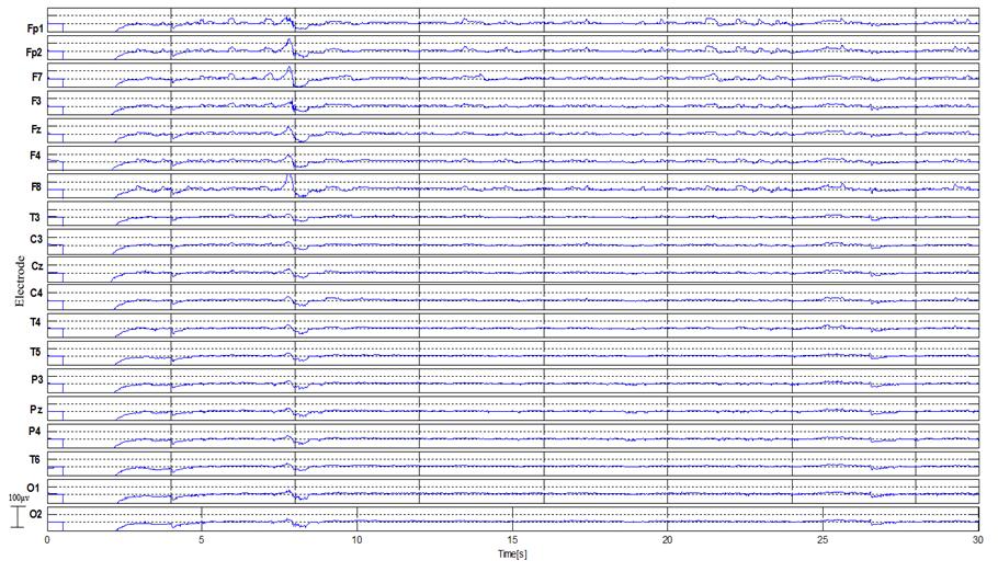 Figure3: Recorded EEG Signal ofthe first subject.