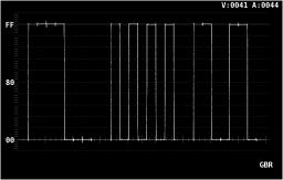 WFM F 1 INTEN/SCALE F 4 SCALE UNIT: HDV,SD% / HDV,SDV /