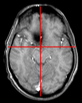 This list is organized in the chronological order of acquisition: 1. Localizer: 3-Plane Gradient Echo (GRE) (20 seconds) 2. 2D Sagittal Spin Echo (SE) (2 minutes) 3.