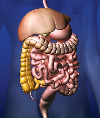 Ce este colita ulceroasă? După cum am spus, colita ulceroasă face parte dintr-un grup de boli, care provoacă inflamaţia tubului digestiv.