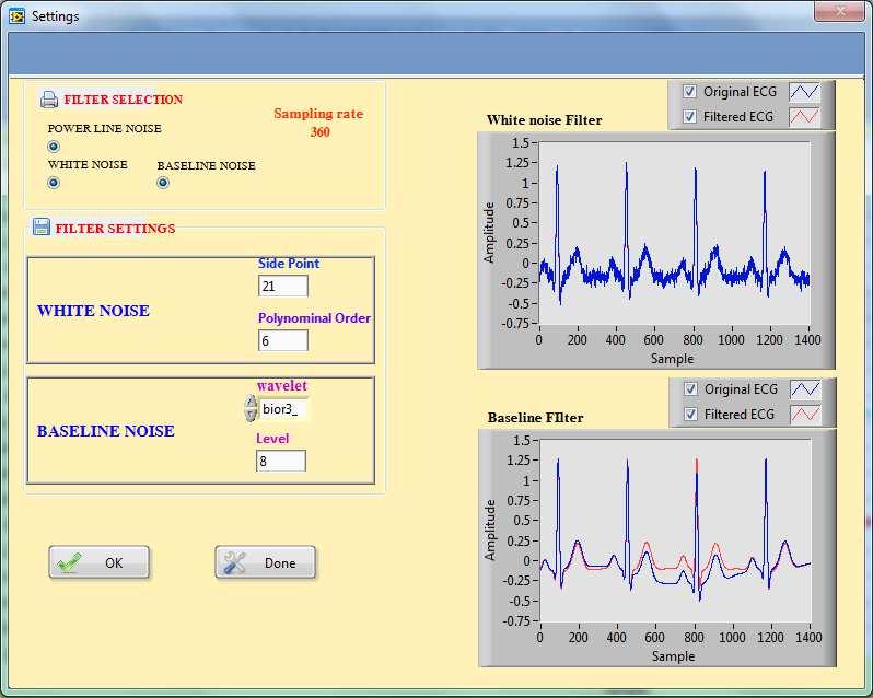 For Signal Noise Ratio (SNR) is determined by formula (3). SNR = 10log 10 ( ) ( ) (3) Figure 5. The graphic user interface of reading ECG database. Figure 6.