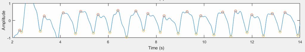 The peaks and valleys detected from the signals corresponds to the number of heart beats within the time interval. Fig. 3(c) shows the detected peaks and valleys.