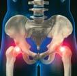 Reumatologie Modalităţi terapeutice artritelor septice trebuie să fie precoce, deoarece leziunile osului şi cartilagiilor, consecutive acţiunii germenelui, pot deveni ireversibile în câteva zile.