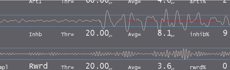 Figure 19: Detail of Trace: Inhibit Band Press F12 to see the in-session waveform. Usually, it has 3 lines two inhibits, one reward.