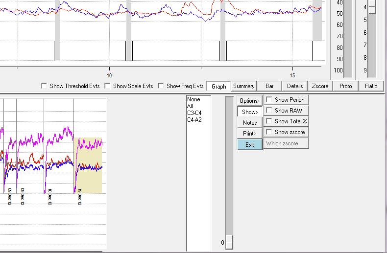 Figure 28: Review Screen Buttons (detail) When you have graph button active above, clicking in different areas of the bottom graph will show you graphically EEG raw traces.