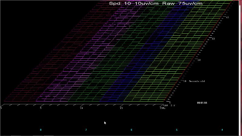 Figure 36: Reduced Width Spectral Display 8.