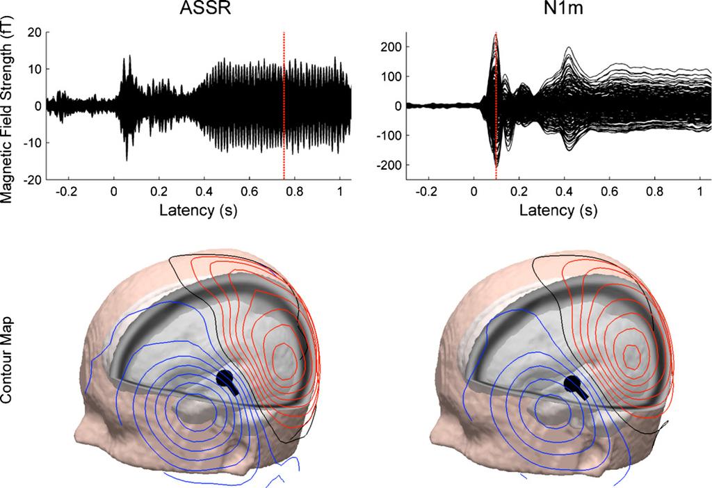 C. Pantev, S.C. Herholz / Neuroscience and Biobehavioral Reviews 35 (211) 214 2154 2151 Fig. 8. Examples of measured auditory evoked magnetic fields and estimated underlying sources.