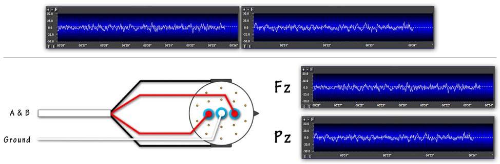 Notice in the center of the main screen shown above that there are two instruments (labeled "A: EEG Raw" and "B: EEG Raw") displaying raw EEG tracings.