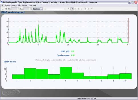 Report - 1 EMG Line graph and trend Report screen for sessions with 1 EMG channel.