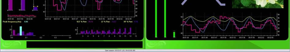 The clinician side screen shows the signal line graphs, with a trend graph of epoch means, while the client side shows the pacer with simple bar graphs and the animation.