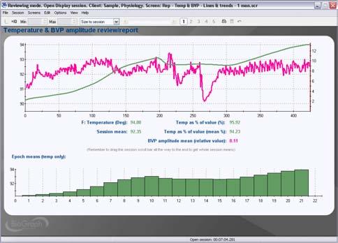 Report - Temp & BVP - Line Graphs and Trends Report screen for multi-modality sessions with BVP (amplitude) and Temp.
