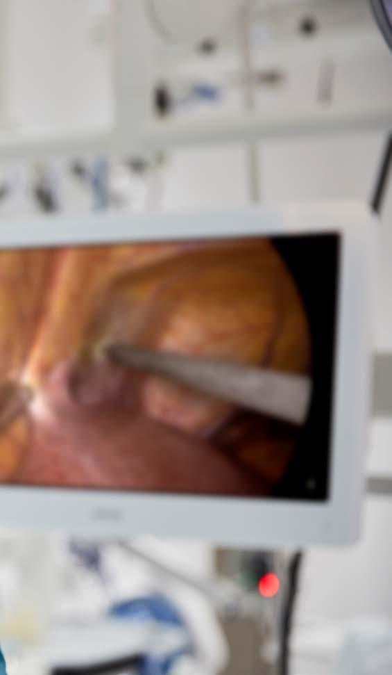 See lifelike images HD and 4K video with perfect color reproduction In image-guided surgery the displays are the eyes of the surgeon.