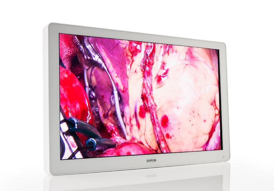 Full HD 32-inch surgical display For the best hand-eye coordination Allows for easy cleaning and disinfection Works with Nexxis for video-over-ip integration Barco s is a 32" near-patient surgical