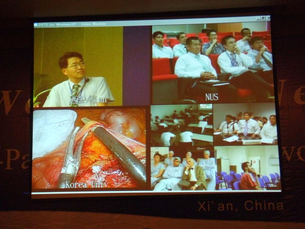 First connection to Europe in telesurgery Xian, CN Seoul, KR