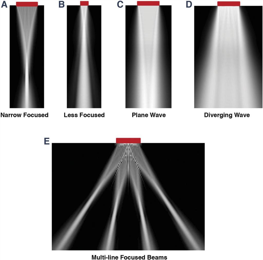 New image formation strategies 96 Ultrafast imaging Uses single transmit to cover larger image region Poor resolution, low SNR High max frame rate