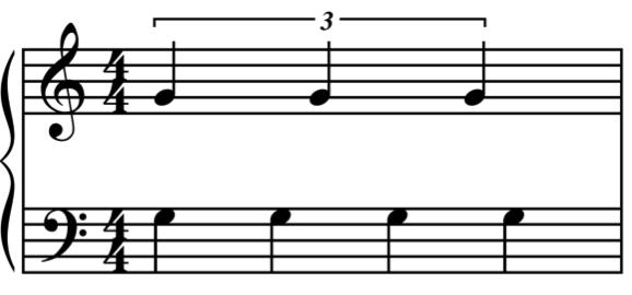 Lesson Two New Terms Tuplet: A note value, beat, or part of a beat can be divided into a number of irregular time values.