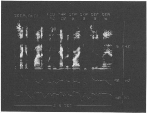 902 Strong and Palmer: Computer-based sound spectrograph system. 902 z 5 EC I FIG. 3. Same as Fig. 2 except a spectral emphasis (SEA) of 6-dB octave staring at 300 Hz (SEF) was used. FIG. 5. Same as Fig. 3 except STP = 2 db per brightness level.