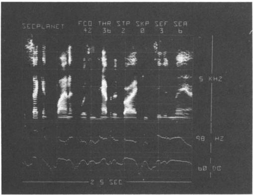It is apparent that much detail is captured even without spectral emphasis. Figure 3 illustrates the effect of a simple spectral emphasis of 6 db per octave (SEA) beginning at 300 Hz (SEF).