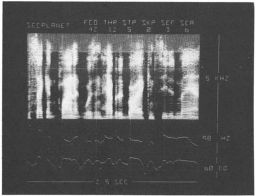 Figure 5 shows a spectrogram in which the step size (ST1)) is set to 2 db per brightness level for a dynamic range of 16 db, which presumably approximates the typical analog situation where contour